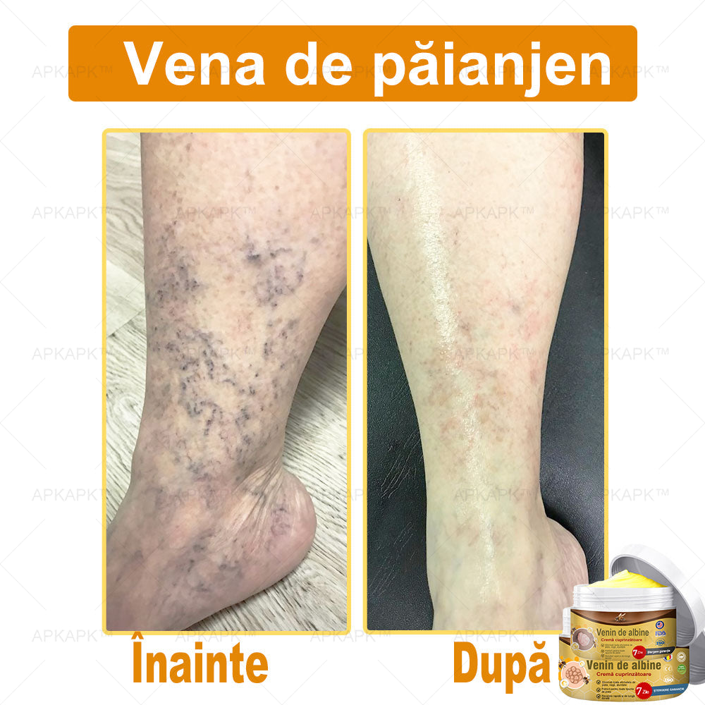 APKAPK™ Cremă Complexă cu Venin de Albine 🌿 Aprobată și Recomandată de AAD